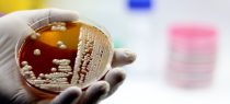 Bifidobacteria Breakthrough: Delhi High Court’s Landmark Ruling in Alimentary Health Limited Case