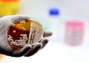 Bifidobacteria Breakthrough: Delhi High Court’s Landmark Ruling in Alimentary Health Limited Case