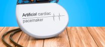 Serendipitous Invention - Artificial Pacemaker