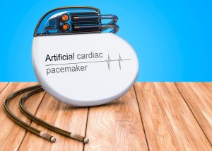 Serendipitous Invention - Artificial Pacemaker